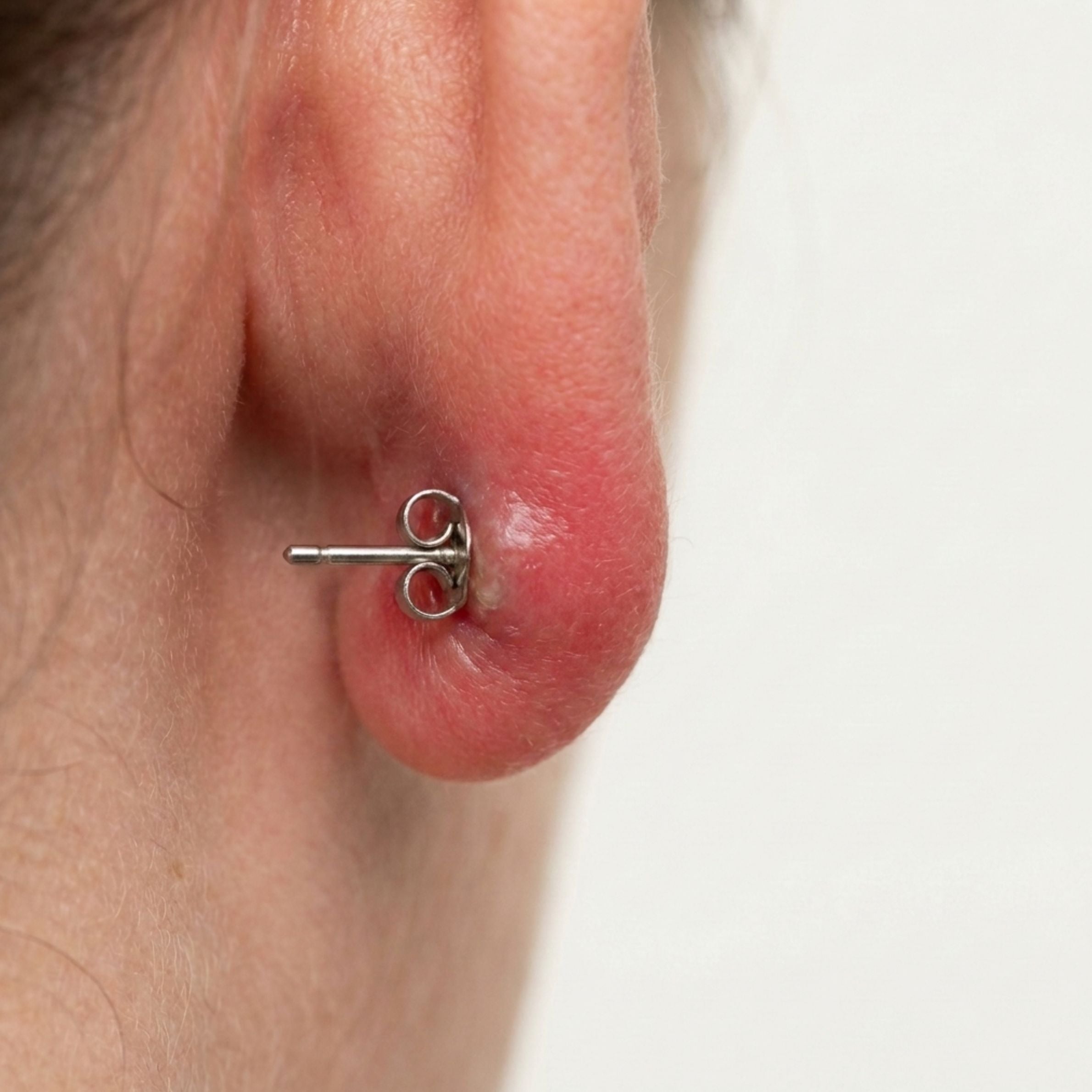 Earring post through skin